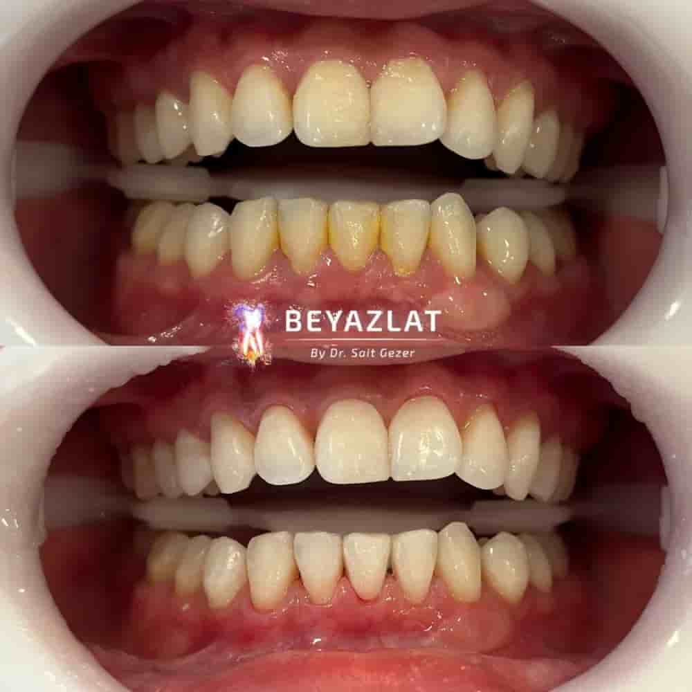 Dr. Sait Gezer في Istanbul، Turkey تعليقات من مرضى حقيقيين
 Slider image 8