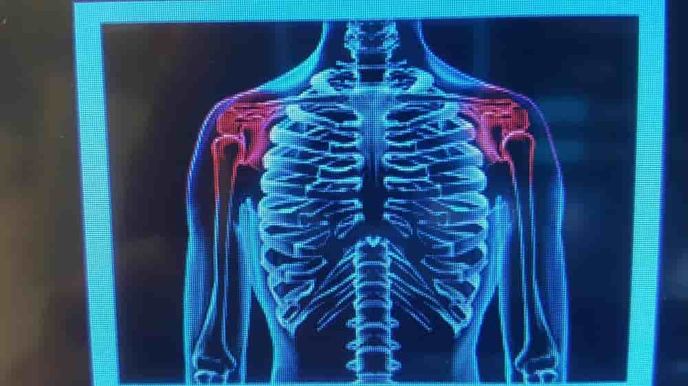 Klinik Piano في Biel، Switzerland تعليقات من مرضى حقيقيين
 Slider image 8