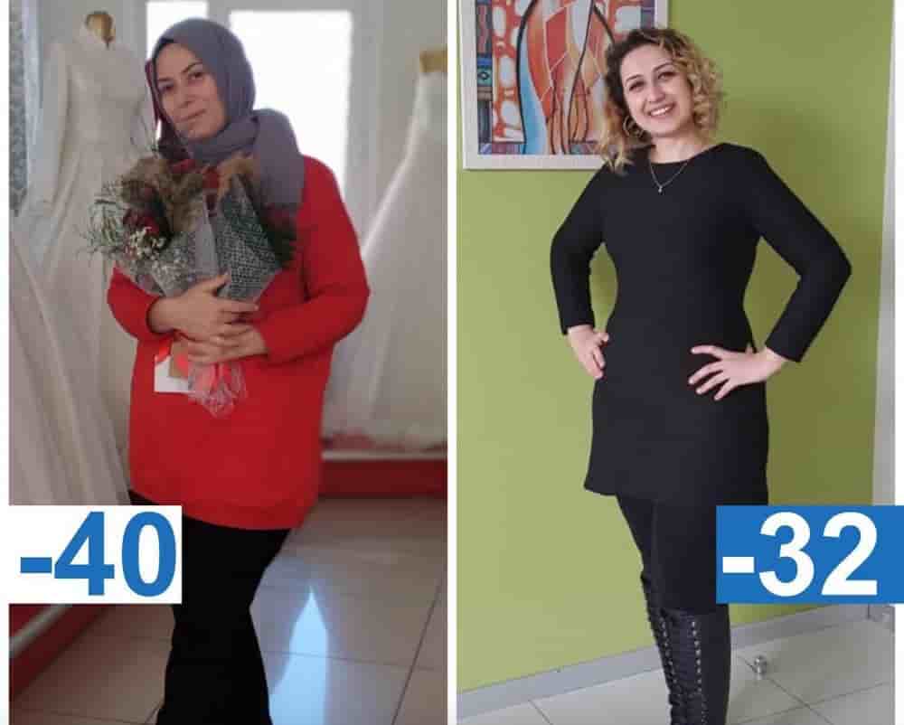 Prof. MD. Umit Koc في Istanbul، Turkey تعليقات من مرضى حقيقيين
 Slider image 7