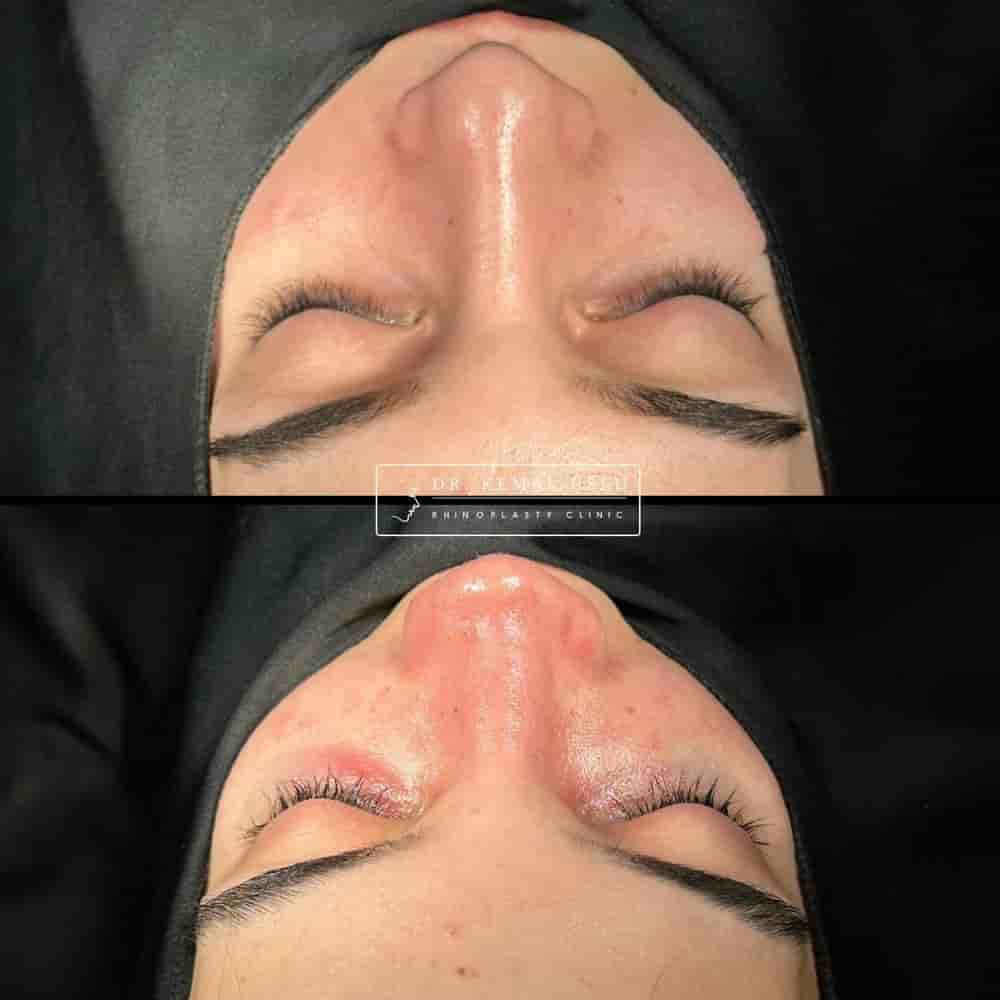 Dr. Kemal Uslu Clinic في Istanbul، Turkey تعليقات من مرضى حقيقيين
 Slider image 3