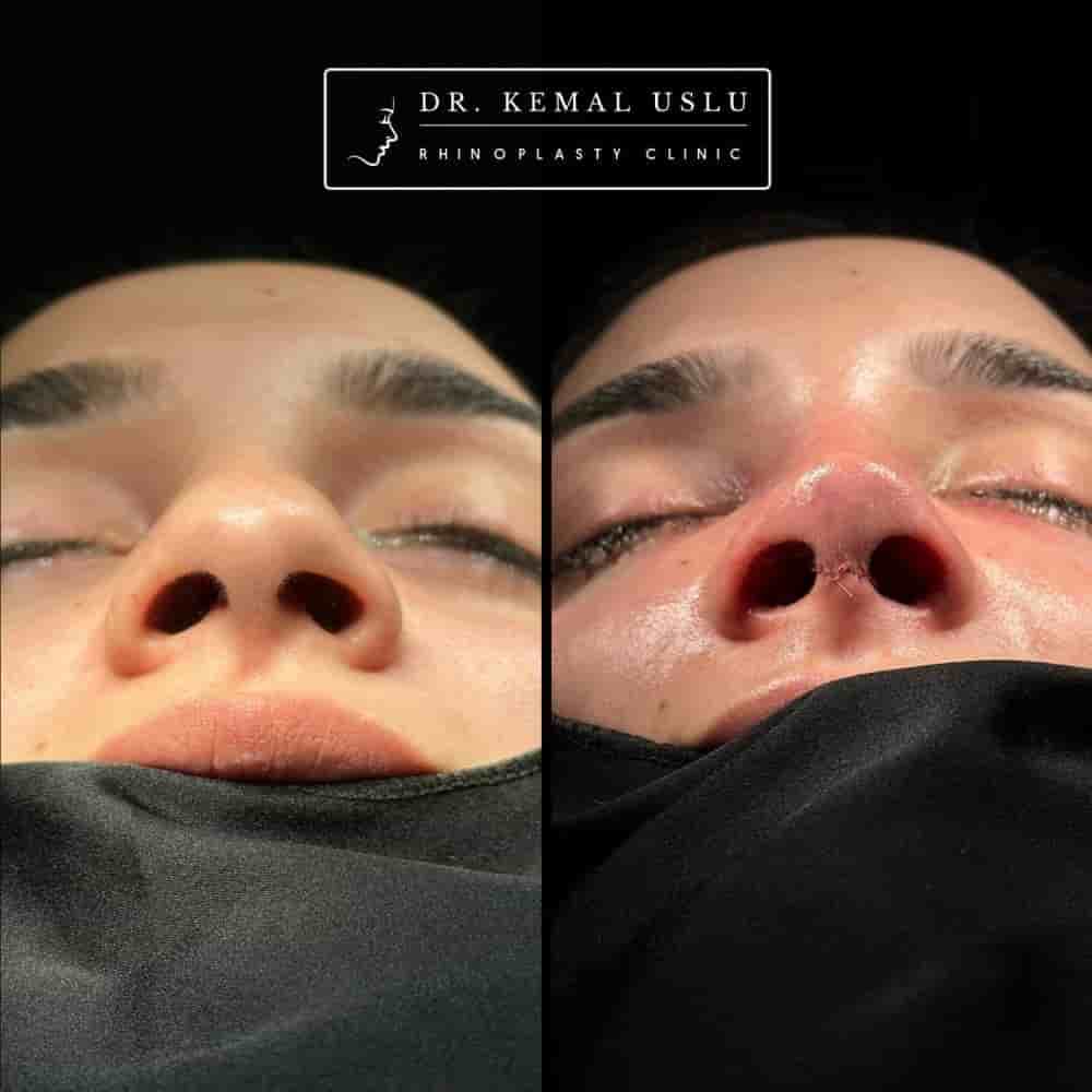 Dr. Kemal Uslu Clinic في Istanbul، Turkey تعليقات من مرضى حقيقيين
 Slider image 4