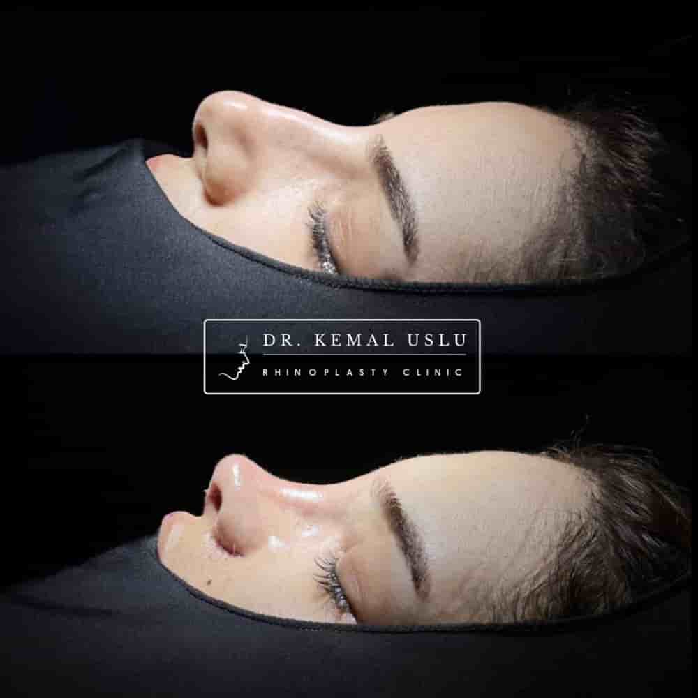 Dr. Kemal Uslu Clinic في Istanbul، Turkey تعليقات من مرضى حقيقيين
 Slider image 5