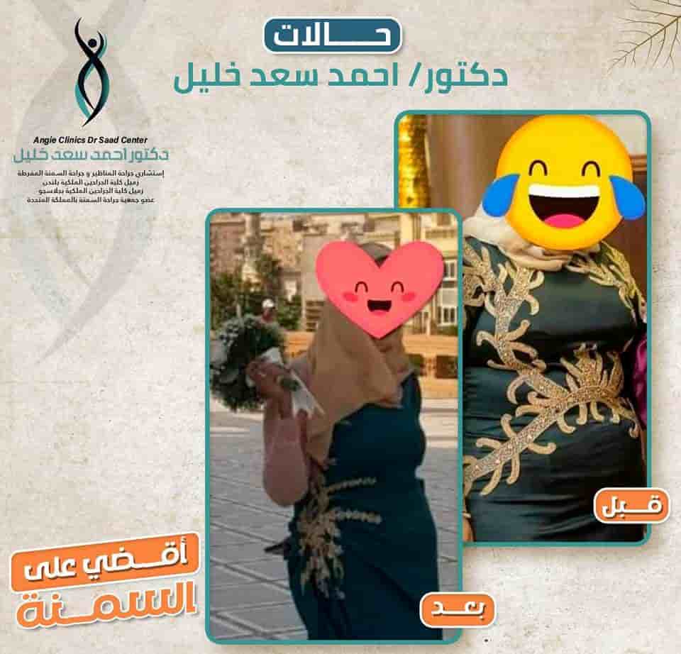 Dr. Ahmed Saad Khalil في Alexandria، Egypt تعليقات من مرضى حقيقيين
 Slider image 2