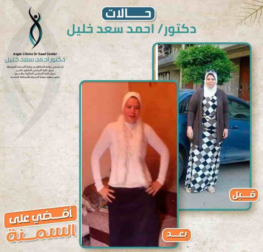 Dr. Ahmed Saad Khalil في Alexandria، Egypt تعليقات من مرضى حقيقيين
 Slider image 3