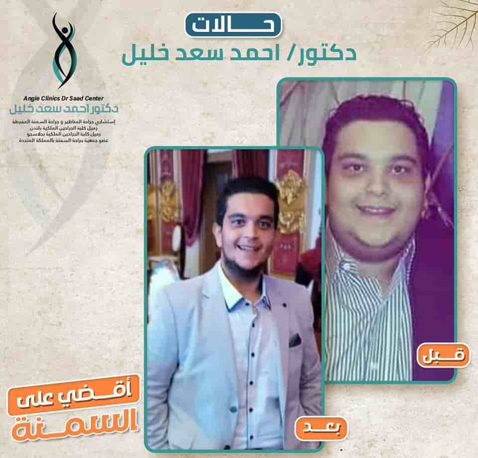 Dr. Ahmed Saad Khalil في Alexandria، Egypt تعليقات من مرضى حقيقيين
 Slider image 4