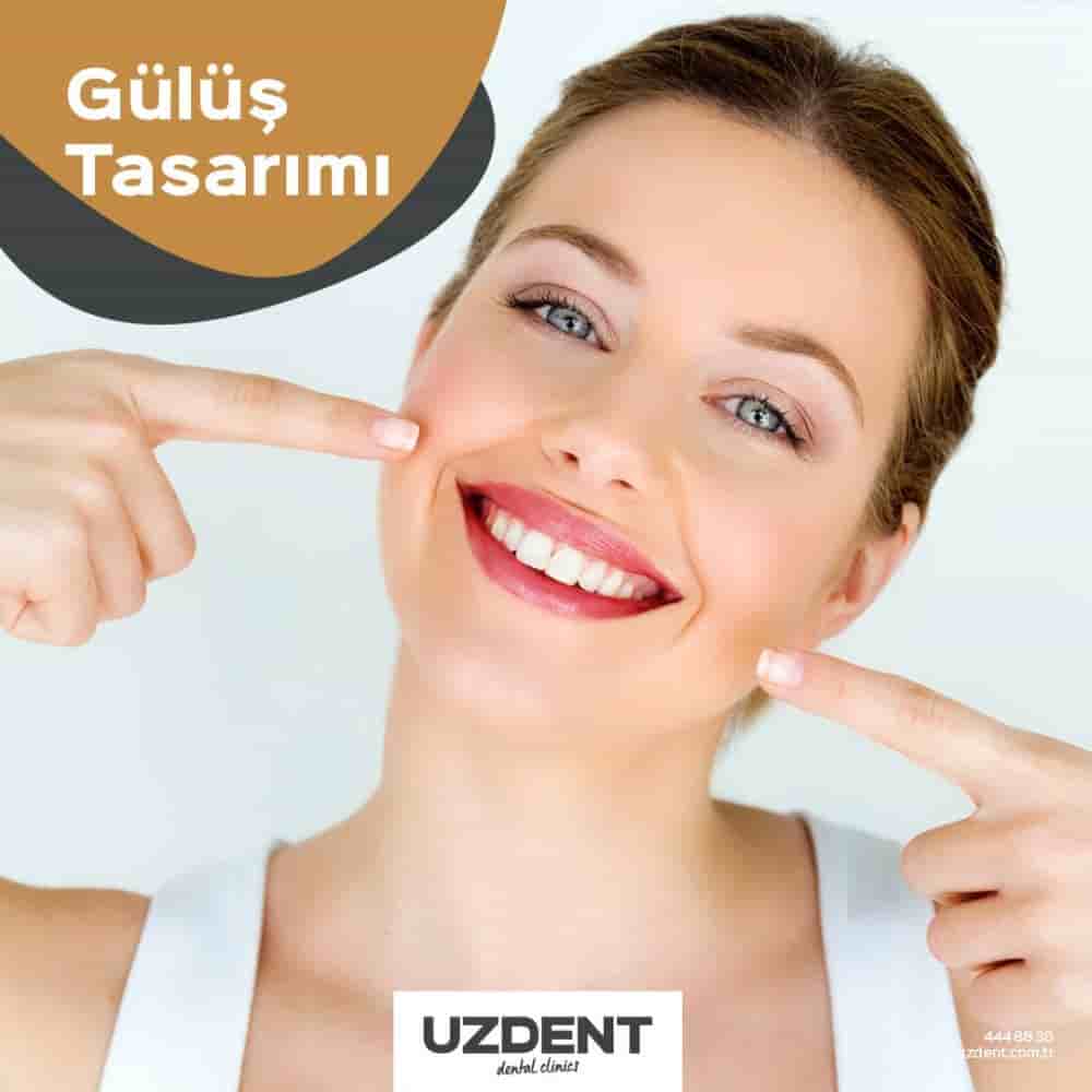 Uzdent Dental Clinics في Istanbul,Kayseri,Nevsehir، Turkey تعليقات من مرضى حقيقيين
 Slider image 3