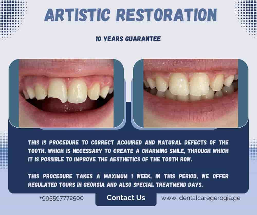 Universe Dental - Best Dental Clinic in Tbilisi, Georgia في Tbilisi، Georgia تعليقات من مرضى حقيقيين
 Slider image 2