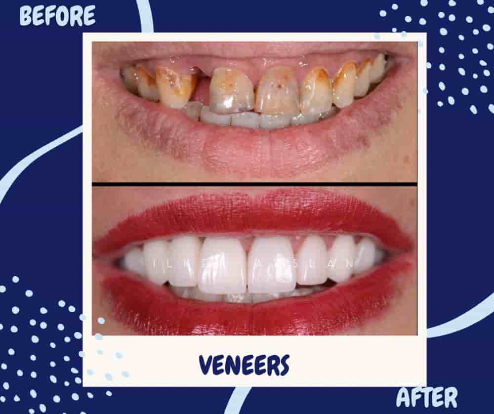 Universe Dental - Best Dental Clinic in Tbilisi, Georgia في Tbilisi، Georgia تعليقات من مرضى حقيقيين
 Slider image 4