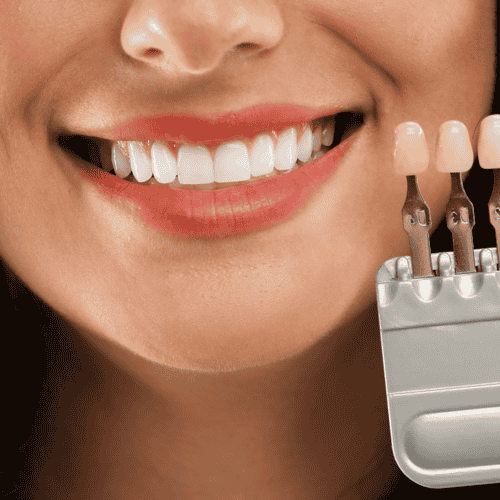 ابتسامة هوليوود في اسطنبول - ابتسامة هوليوود، زراعة الأسنان، تيجان الأسنان في اسطنبول