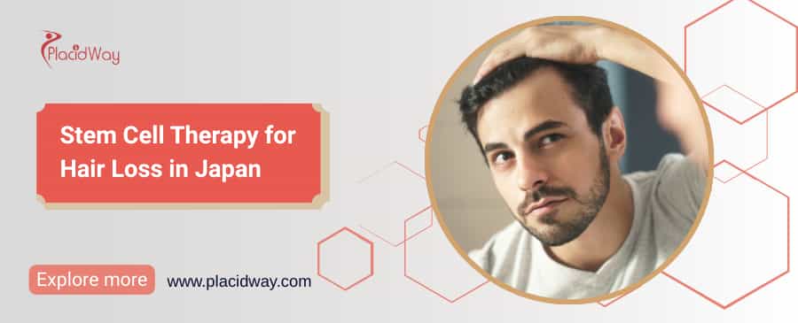 علاج تساقط الشعر بالخلايا الجذعية في اليابان thumbnail