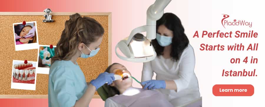 زراعة الأسنان All on 4 في اسطنبول تركيا thumbnail