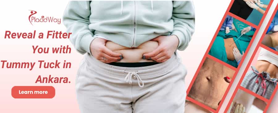 شد البطن في أنقرة، تركيا thumbnail