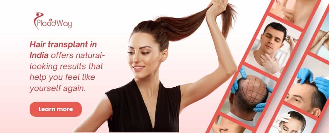 زراعة الشعر في الهند thumbnail