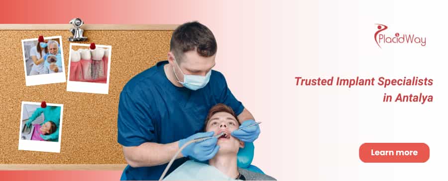 زراعة الأسنان All on 4 في أنطاليا thumbnail