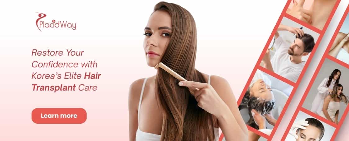 زراعة الشعر في كوريا الجنوبية thumbnail