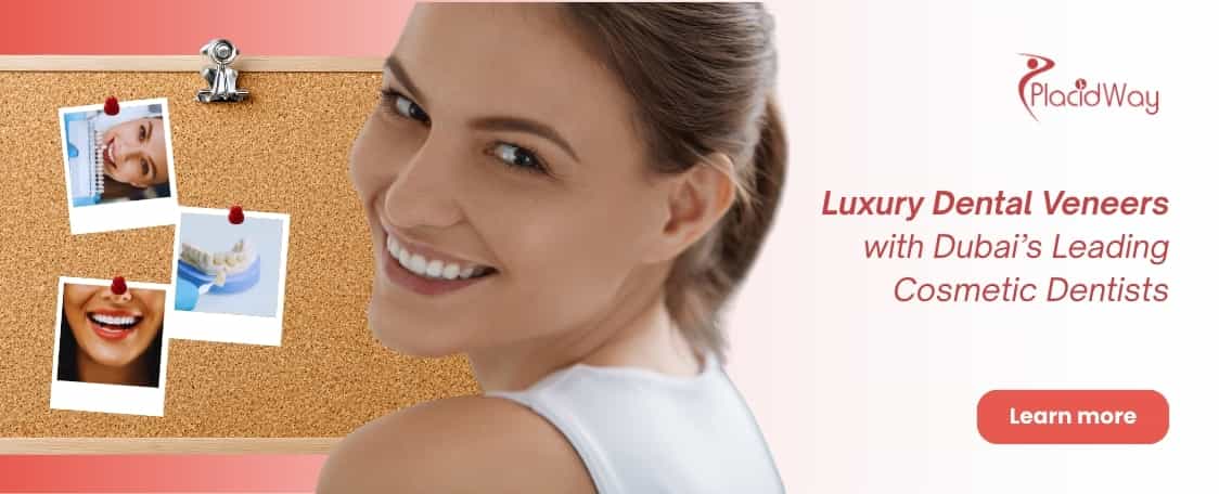 قشور الأسنان في دبي الإمارات العربية المتحدة thumbnail