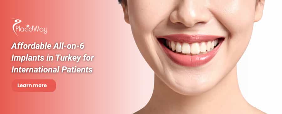 زراعة الأسنان All on 6 في تركيا thumbnail