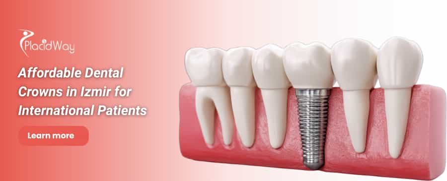 تيجان الأسنان في إزمير، تركيا thumbnail