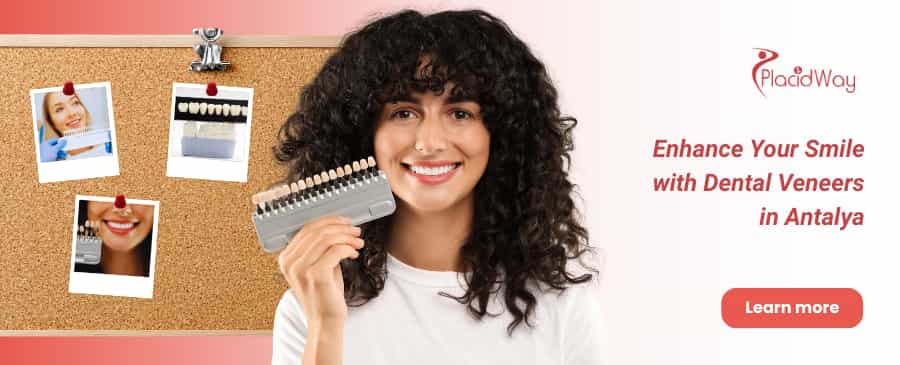 قشور الأسنان في أنطاليا thumbnail