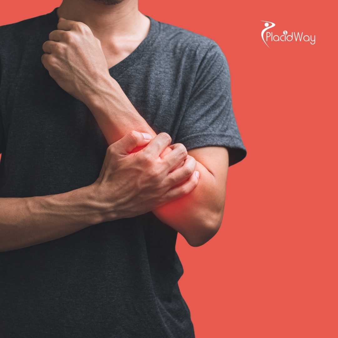 العلاج بالخلايا الجذعية في الإمارات العربية المتحدة لإصابات العظام: دليل للمرضى من الهند