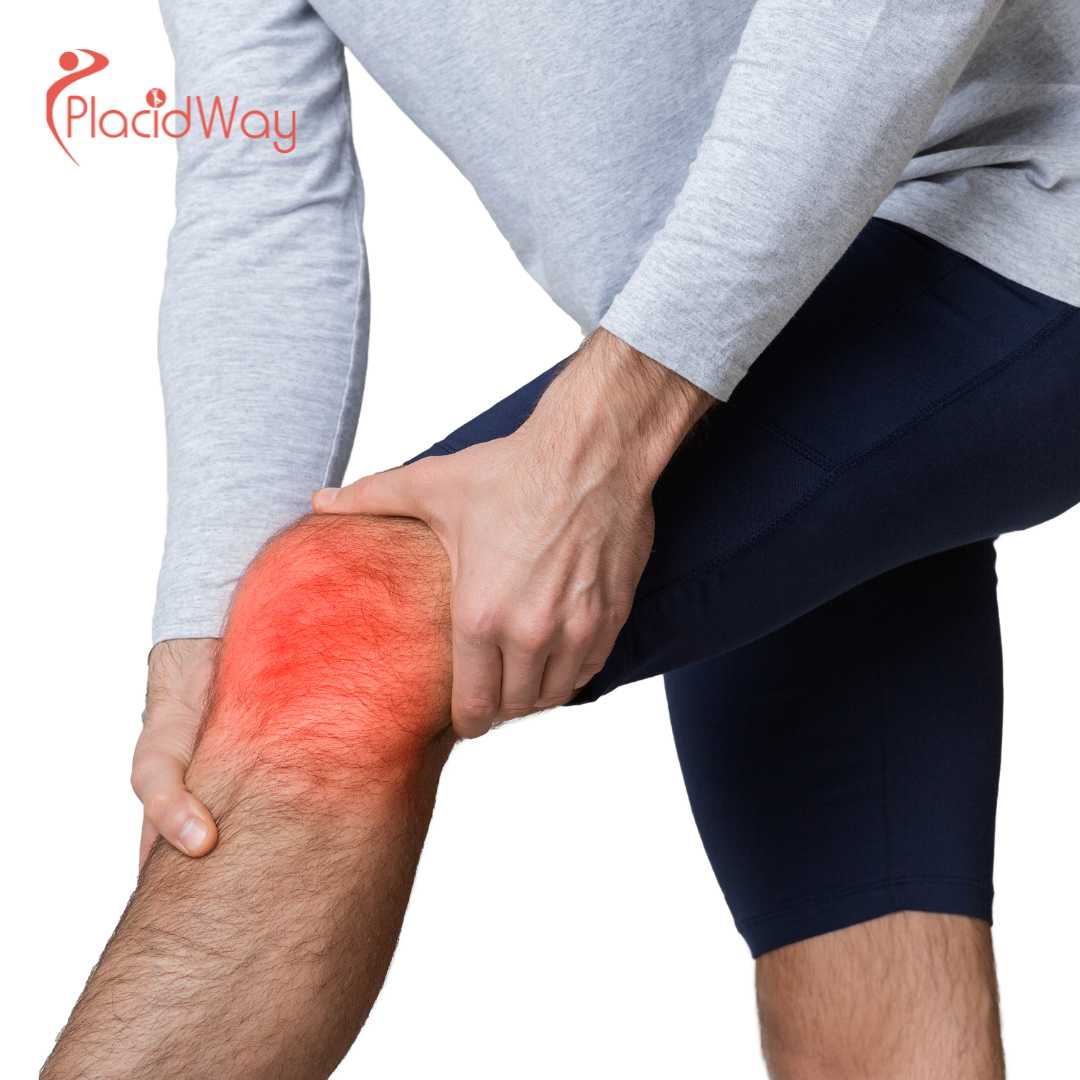 خمس فوائد لإصلاح الغضروف الهلالي في إسطنبول، تركيا