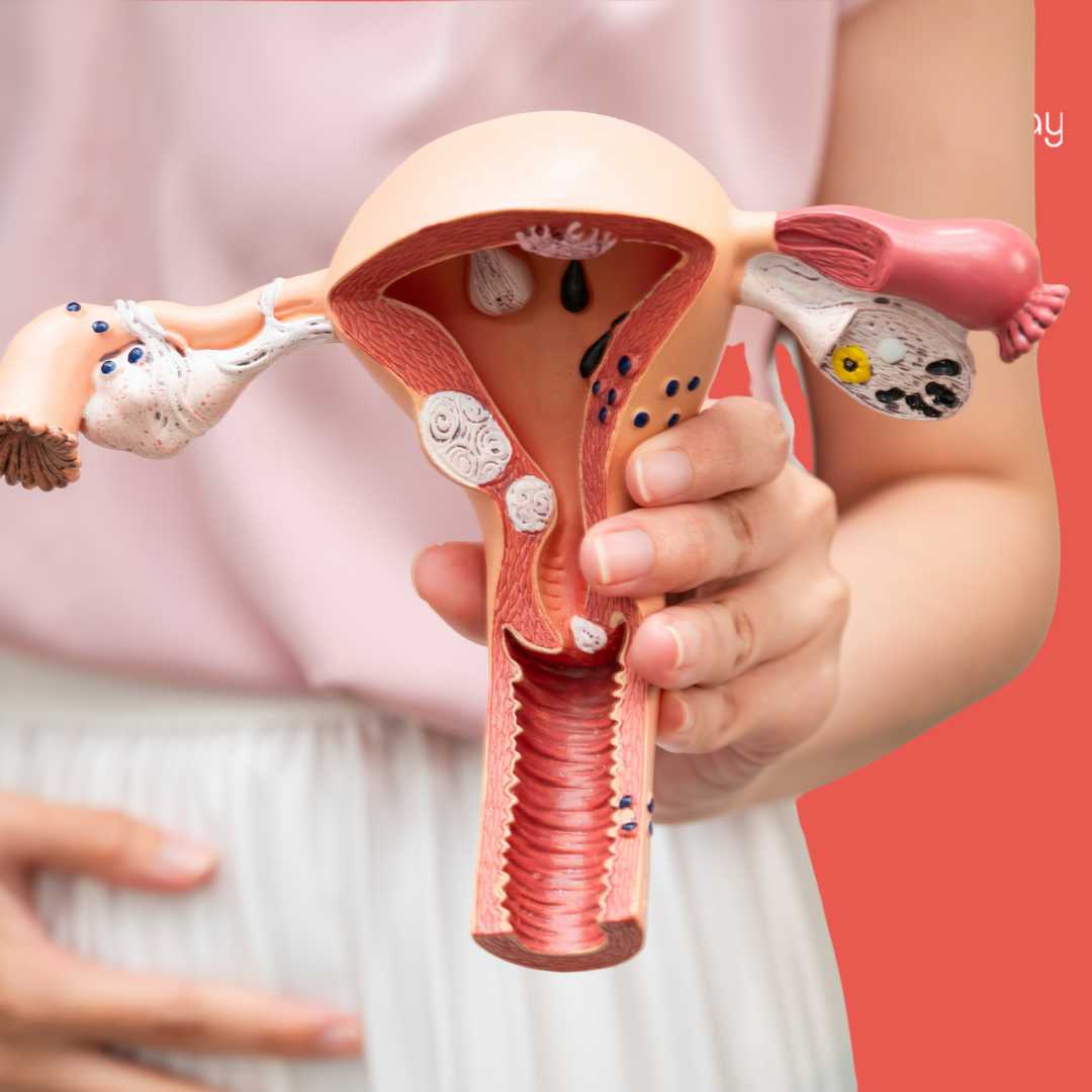 علاج أمراض النساء في تركيا