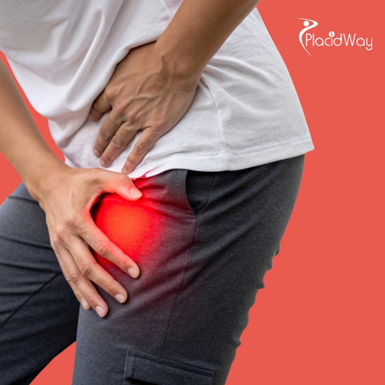 استبدال الورك في الهند - احصل على حزمة جراحة الورك الفعالة