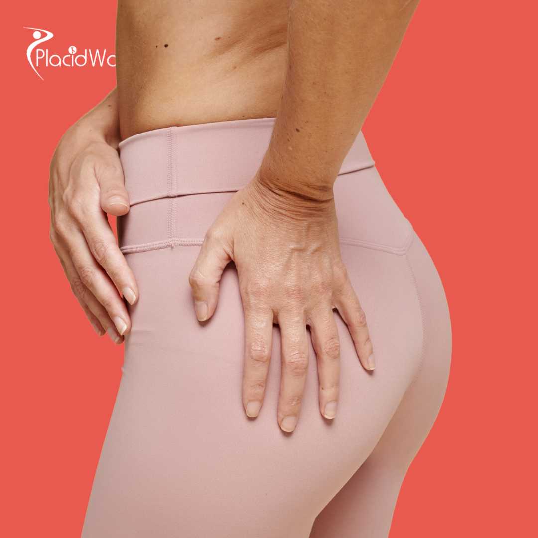 عملية تكبير المؤخرة البرازيلية في اليونان