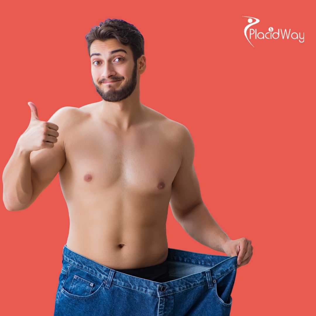 جراحة تكميم المعدة في إسطنبول، تركيا