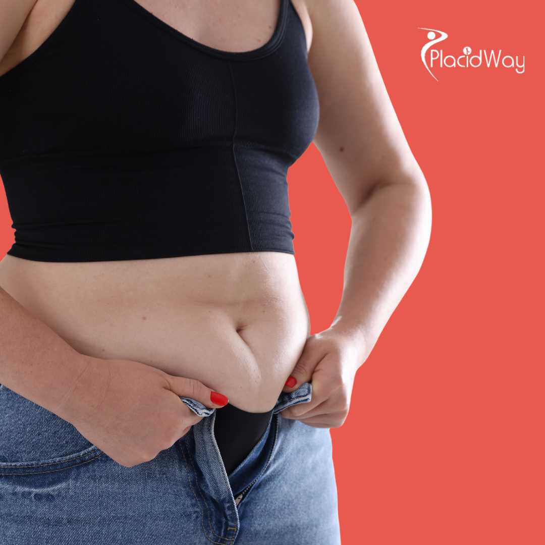 شفط الدهون في اسطنبول تركيا