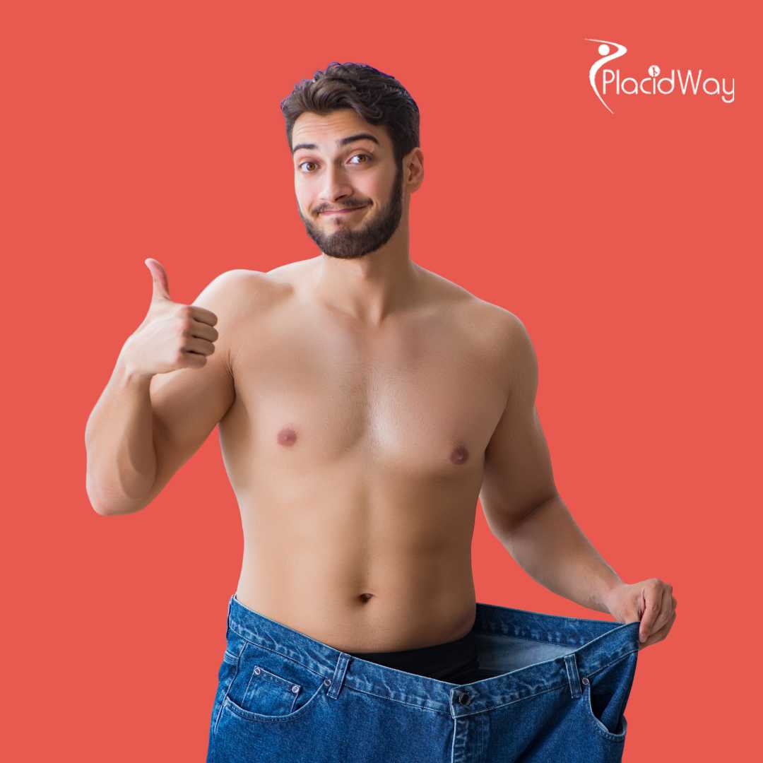 تحويل مسار المعدة في تركيا - التكلفة، العيادات، المراجعات، الأطباء