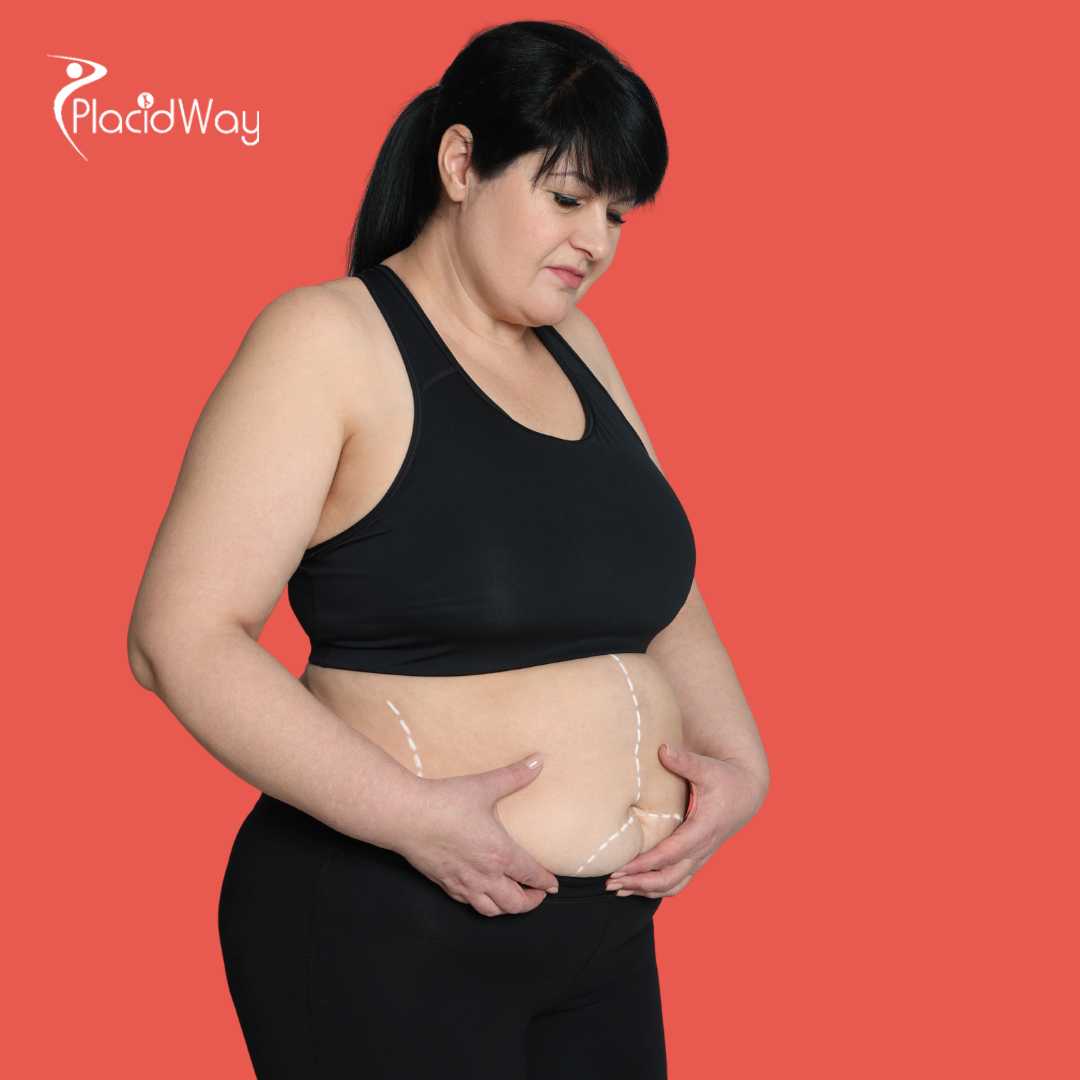 شد البطن في بانكوك، تايلاند