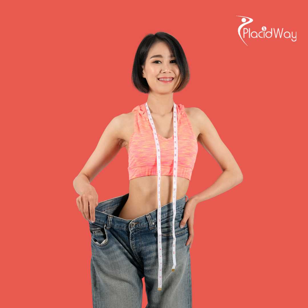 جراحة السمنة في أنطاليا تركيا