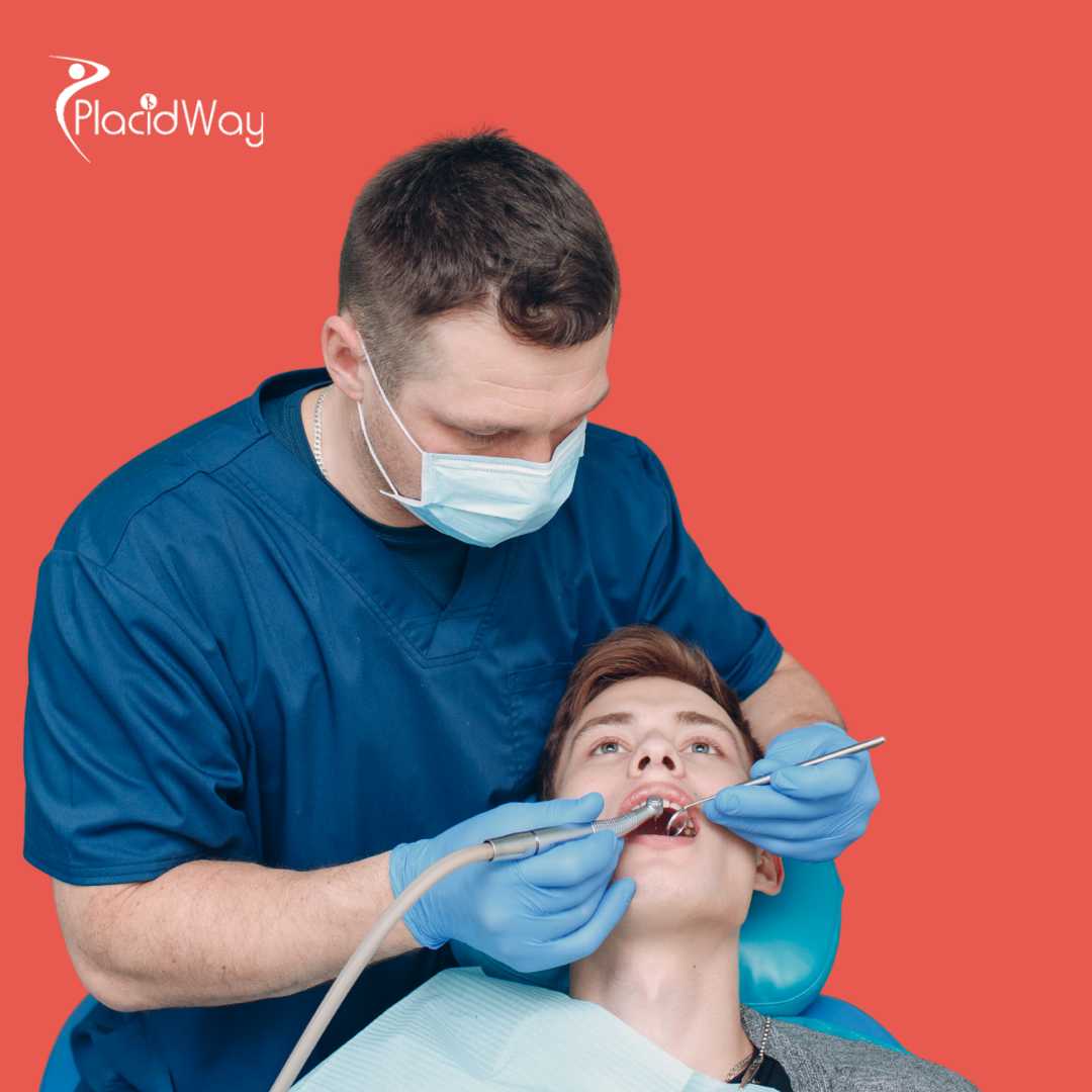 زراعة الأسنان All on 4 في أنطاليا