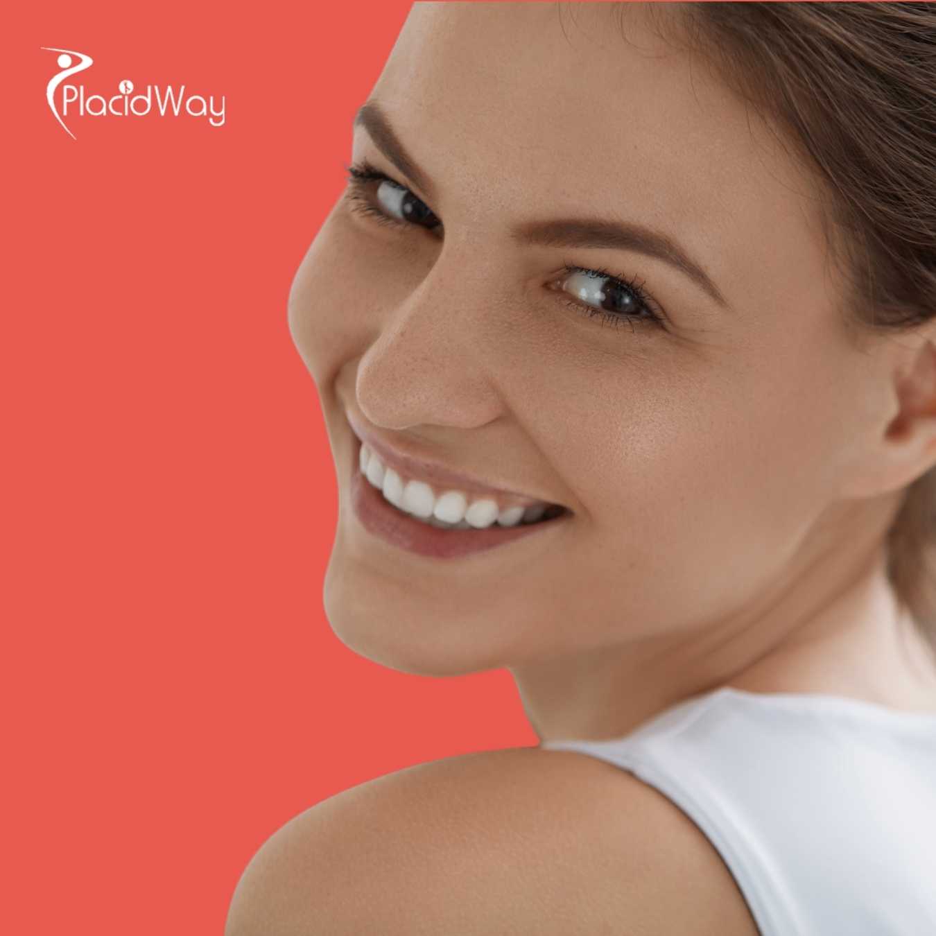 قشور الأسنان في دبي الإمارات العربية المتحدة