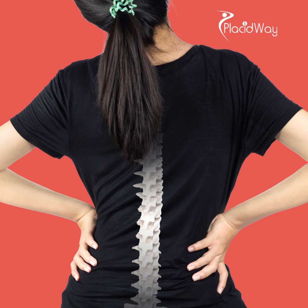 جراحة العمود الفقري في أنقرة، تركيا