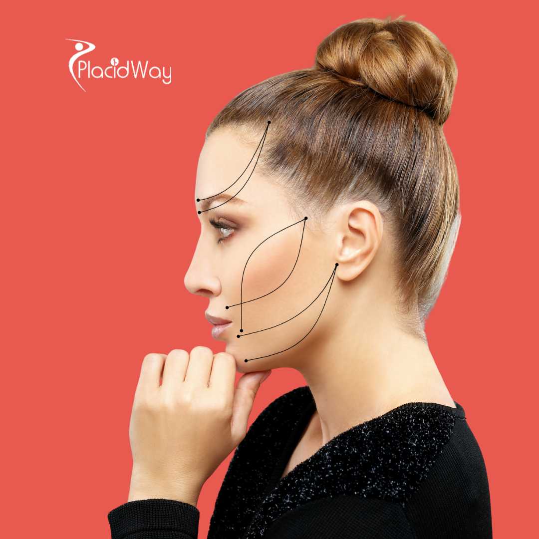 شد الوجه في اسطنبول تركيا