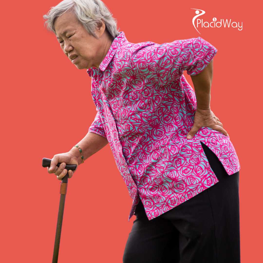 جراحة استبدال الورك في إسطنبول، تركيا