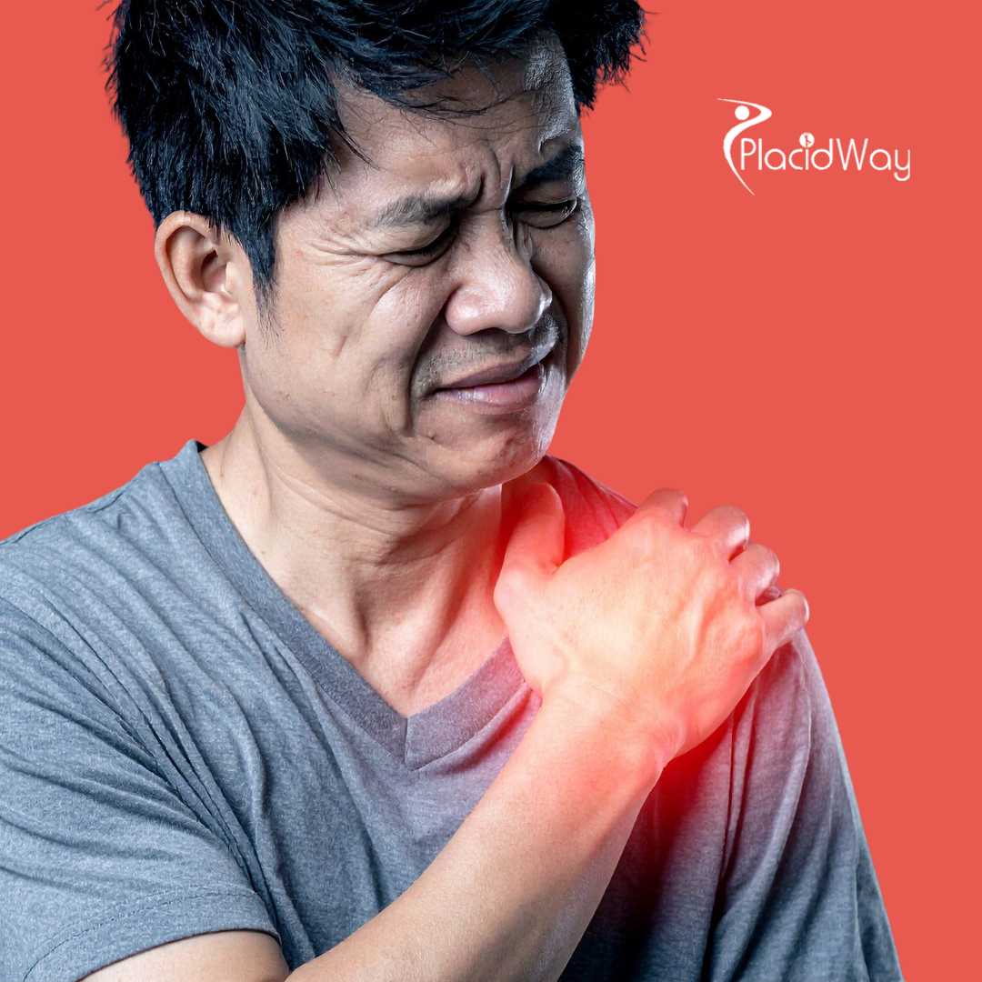 جراحة استبدال مفصل الكتف في بورصة، تركيا 