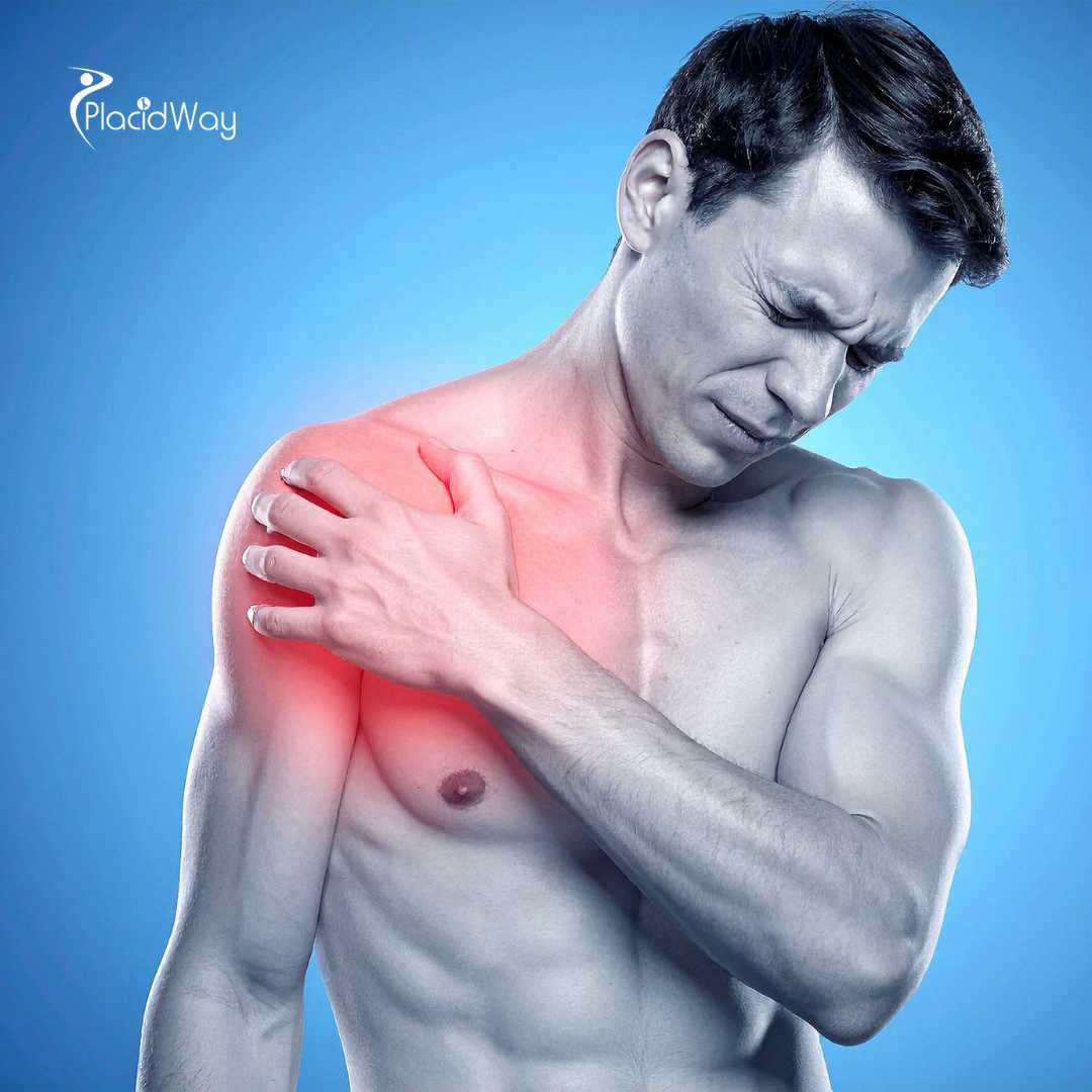 علاج المفاصل بالخلايا الجذعية في تايلاند