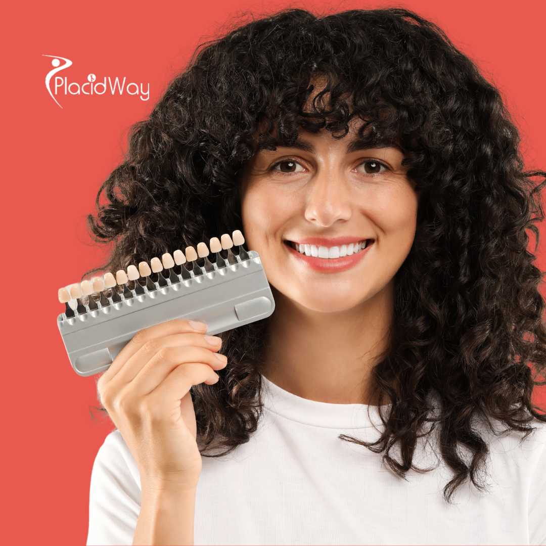 قشور الأسنان في أنطاليا