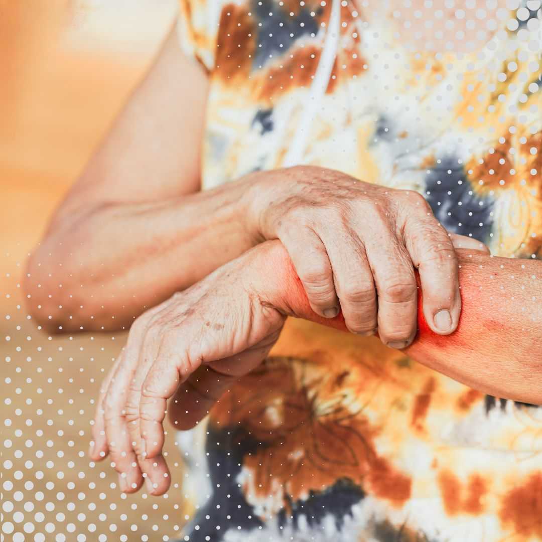 باقة علاج الخلايا الجذعية لمرض الذئبة وأمراض المناعة الذاتية في كوالالمبور، ماليزيا، من شركة فيرست سيل