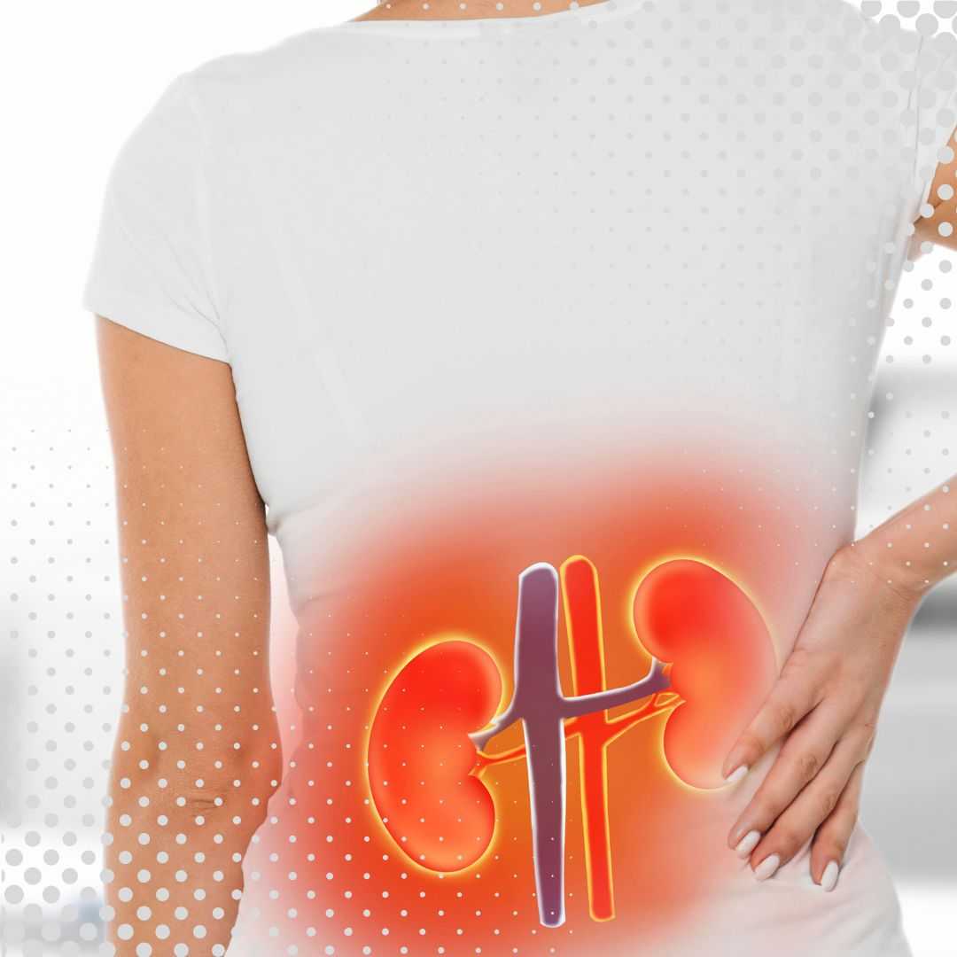 باقة علاج الخلايا الجذعية للفشل الكلوي في كوالالمبور، ماليزيا، من شركة فيرست سيل