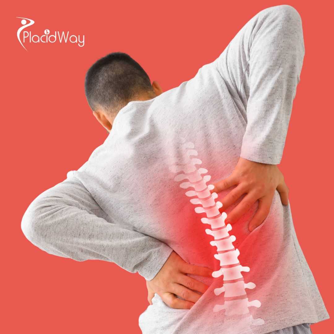 علاج متقدم للقرص التنكسي باستخدام باقة الخلايا الجذعية في بانكوك من عيادة فيجا