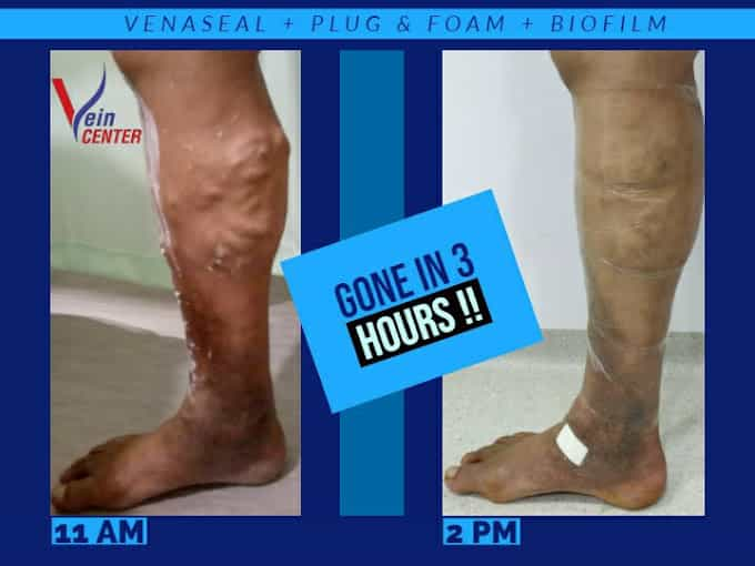 The Vein Center India