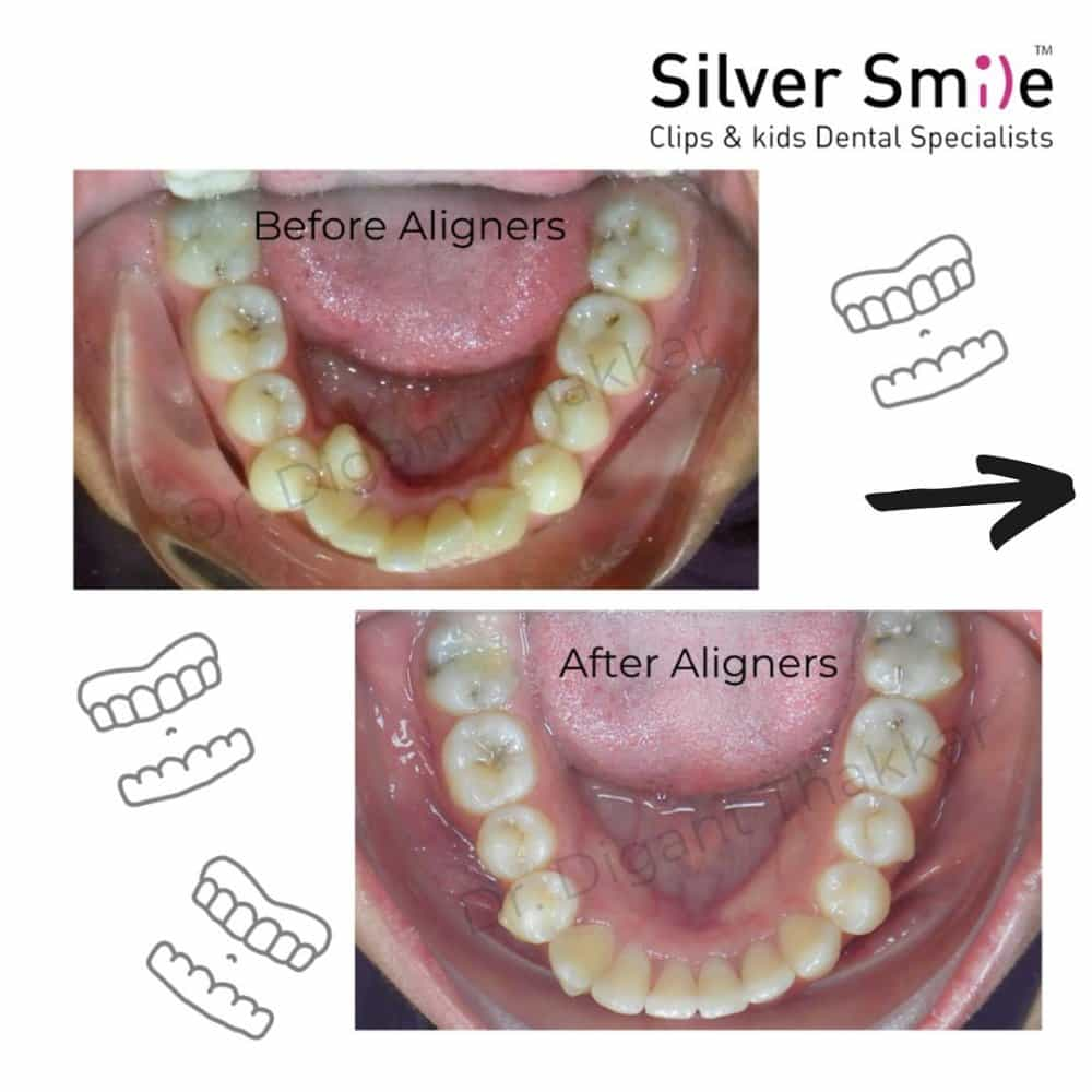 Silver Smile Dental Specialist