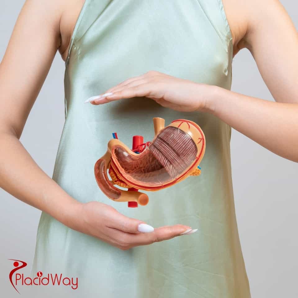 ما هي العيادات التي تقدم عملية تحويل مسار المعدة الشاملة في تركيا؟