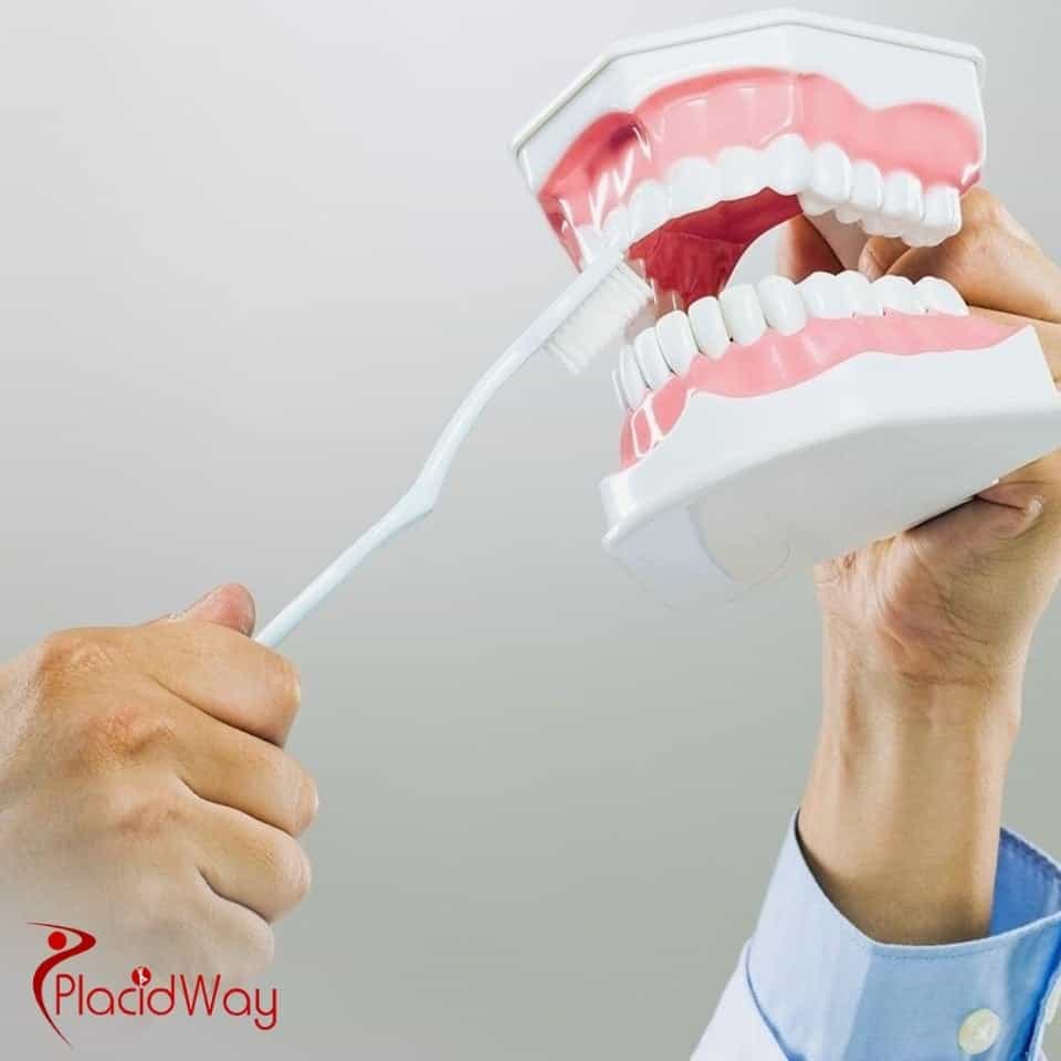 ماذا تشمل عادةً عروض زراعة الأسنان الكاملة في تركيا؟