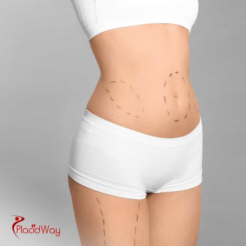 ما هي الدولة التي تقدم عمليات شفط الدهون بأقل الأسعار؟