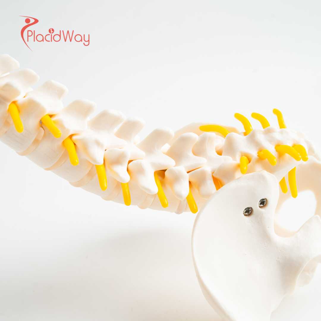 هل يمكن أن يساعد العلاج بالخلايا الجذعية في تايلاند على عكس مرض القرص التنكسي؟